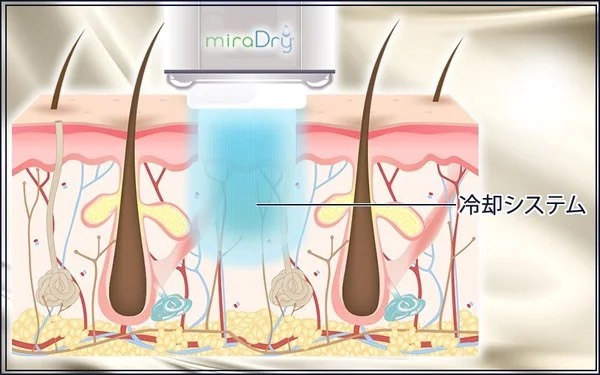 冷却と保護の仕組み