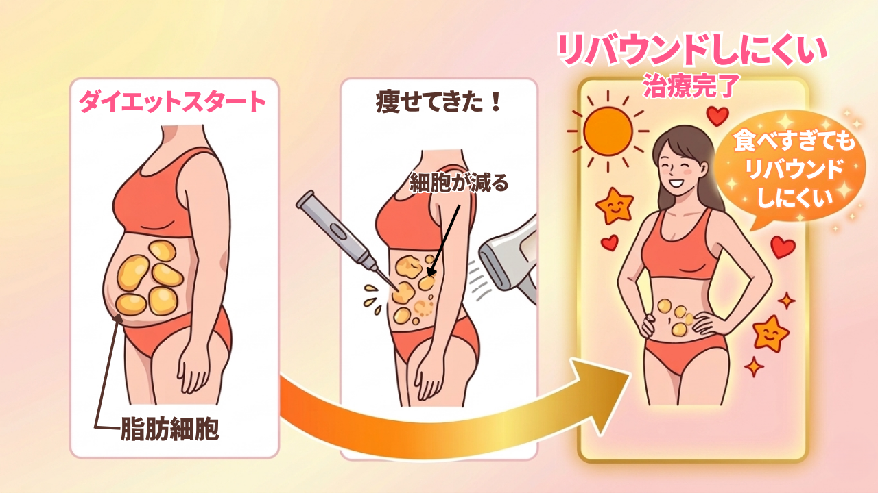 脂肪溶解注射の仕組み